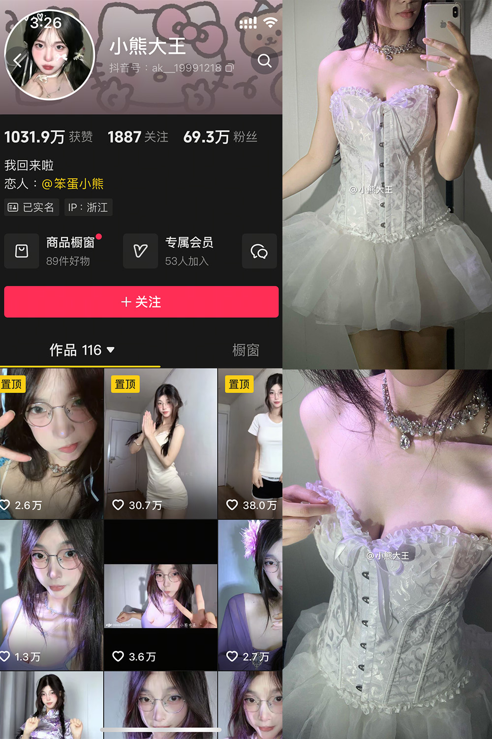 抖音 小熊大王 微密圈 001期 【32P】-微密圈